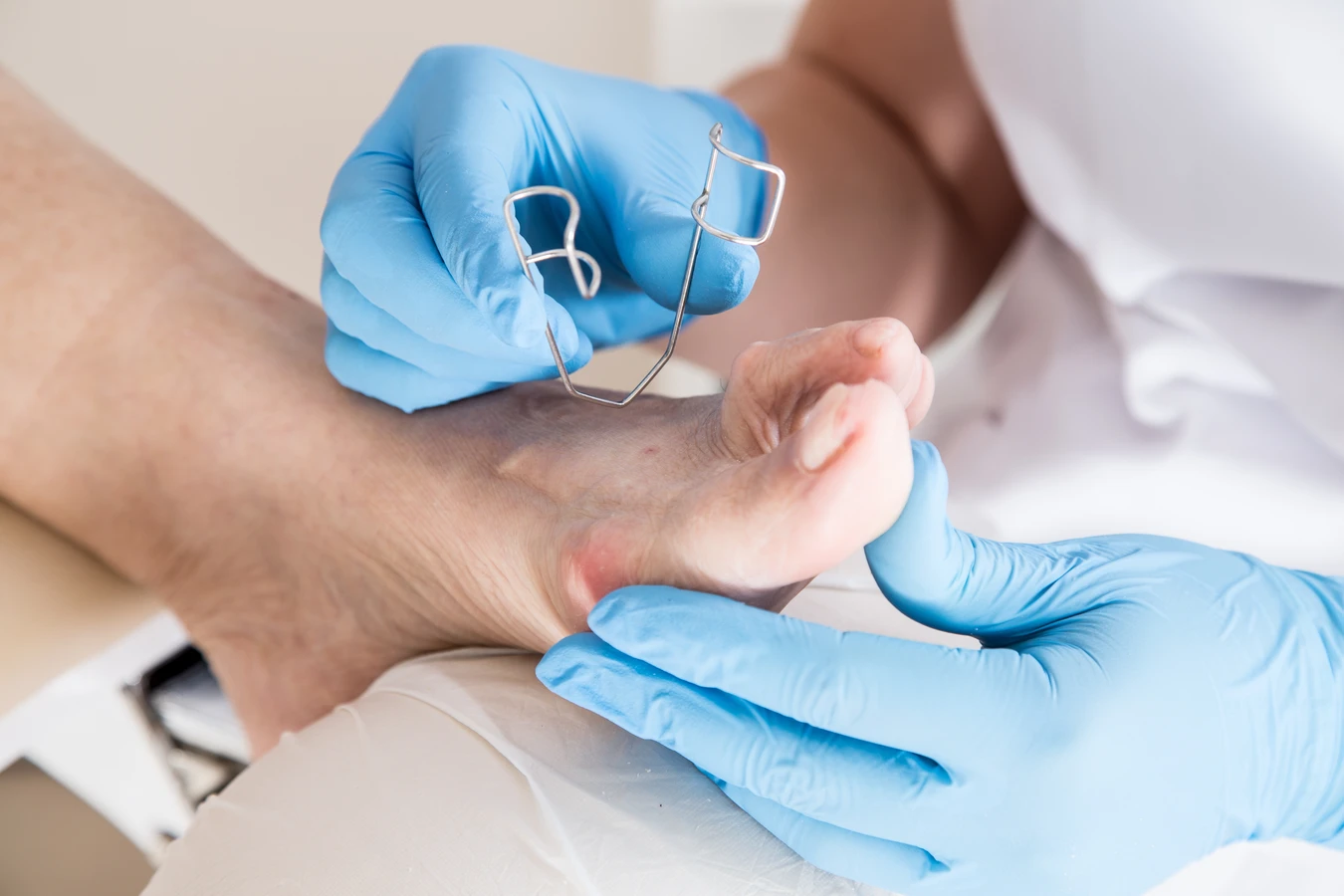 Pedicure leczniczy Warszawa