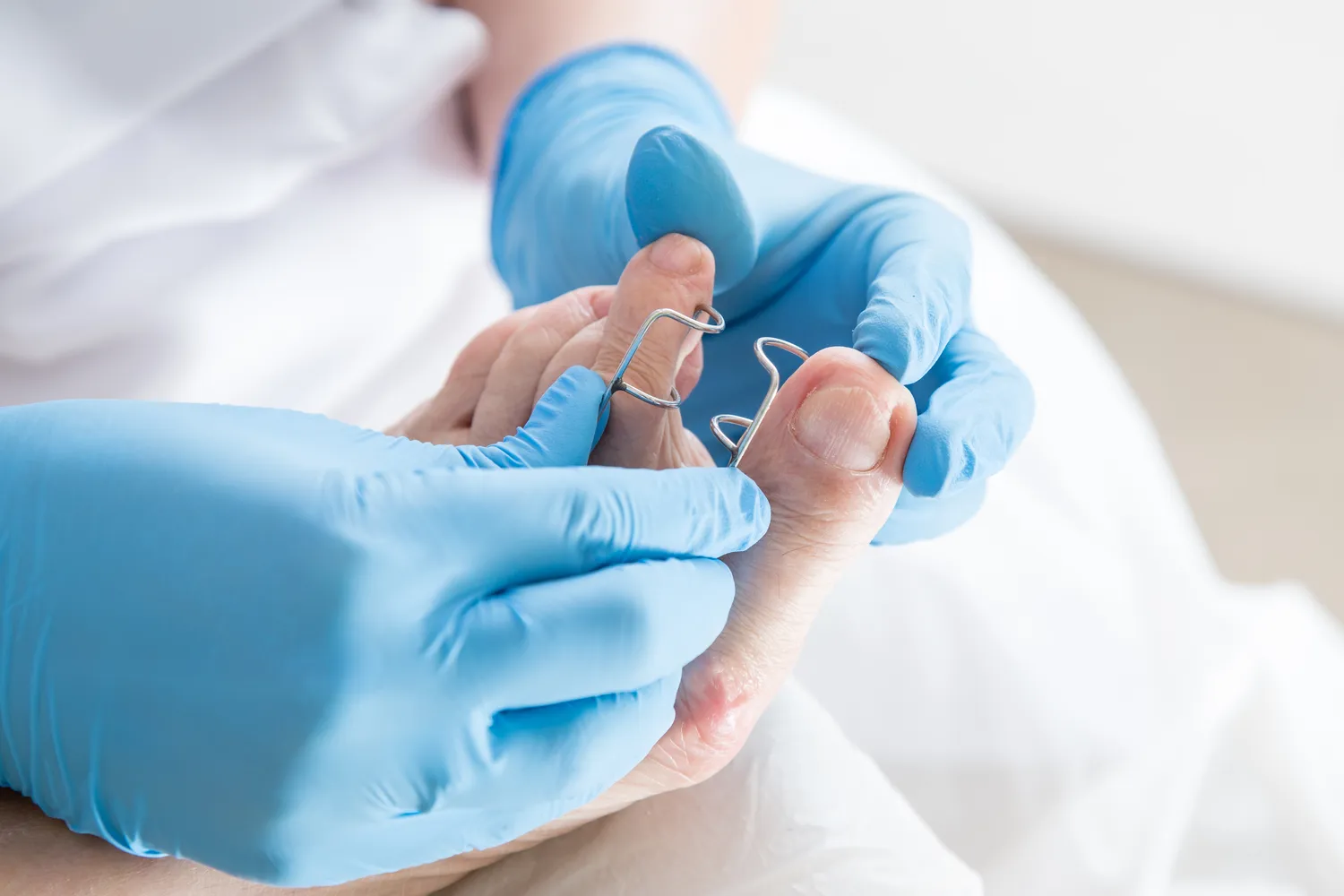 Podologia, czyli jak pozbyć się problemów ze stopami?